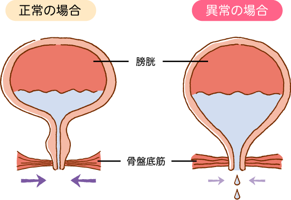 過活動膀胱が発症するしくみのイラスト画像
